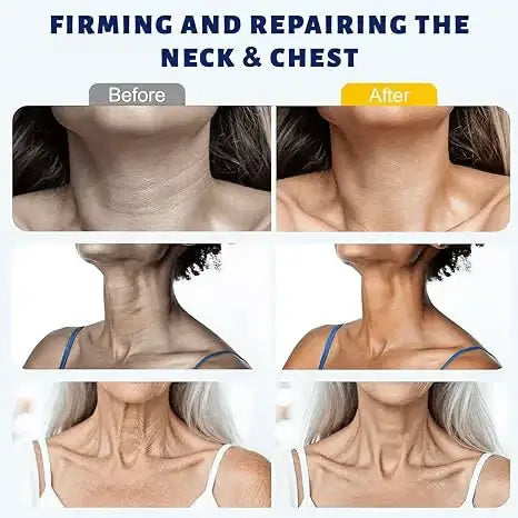 Instant Neck Lift Cream