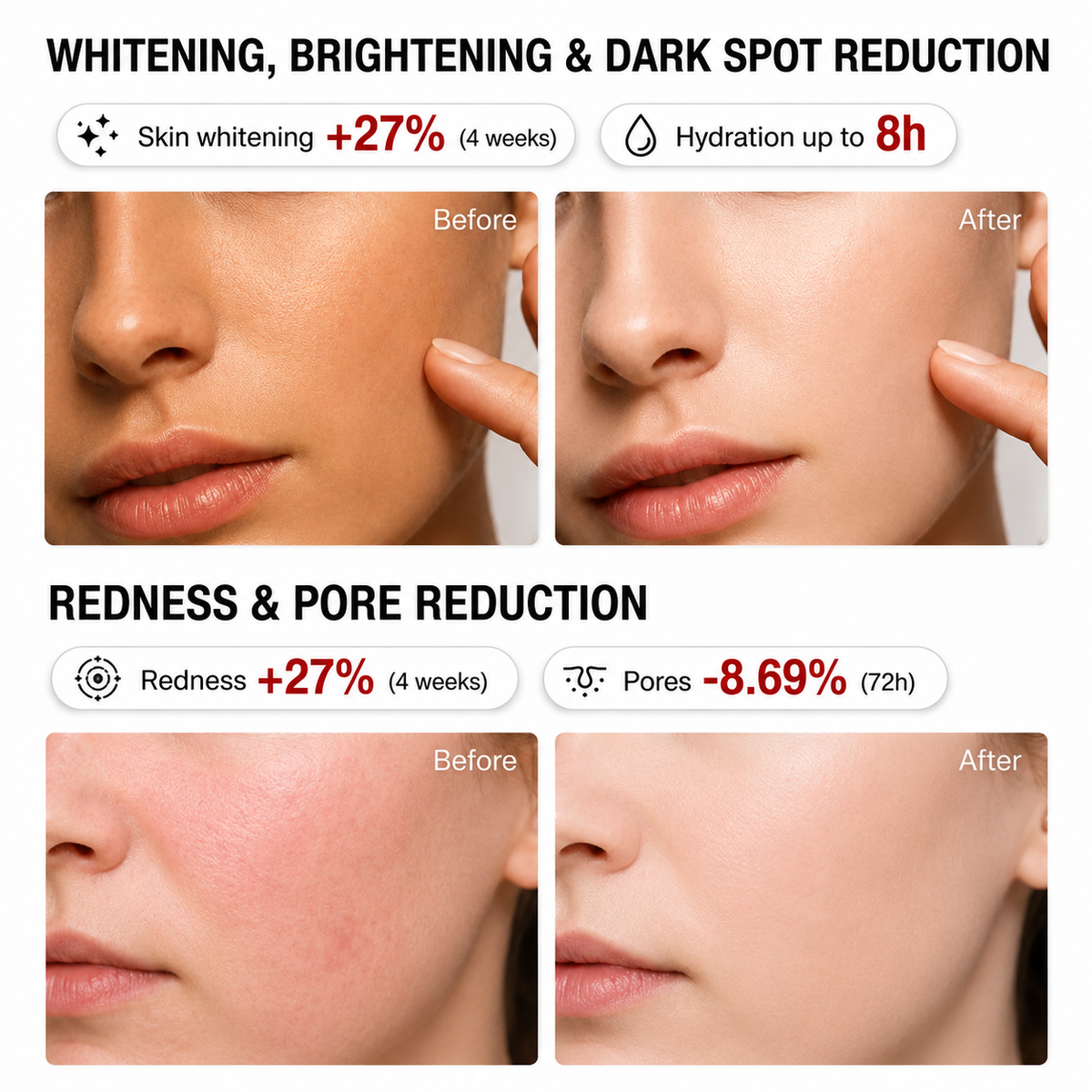 ⏳🔥Last Day-Buy 1 Get 1 Free🔥⏰Niacinamide Brightening Essence, Reduces Acne Scars and Dark Spots, Whitening Serum